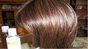 Remboursement prothèse capillaire : comment l’obtenir ?
